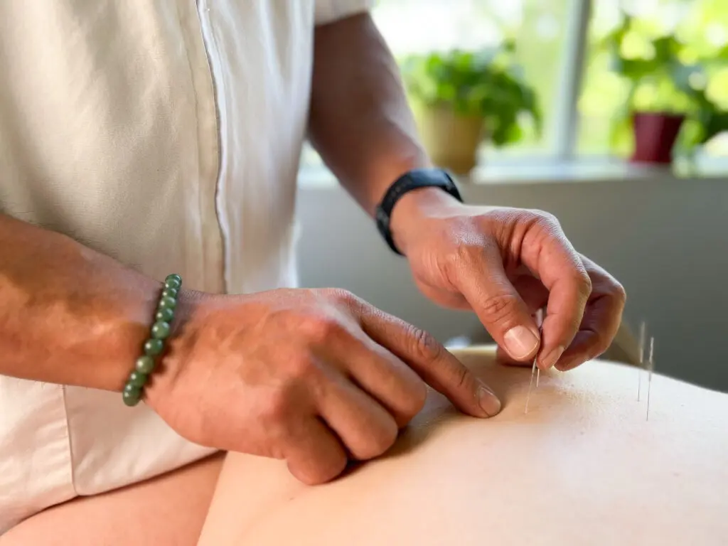 Acupuncture treatment in the clinic