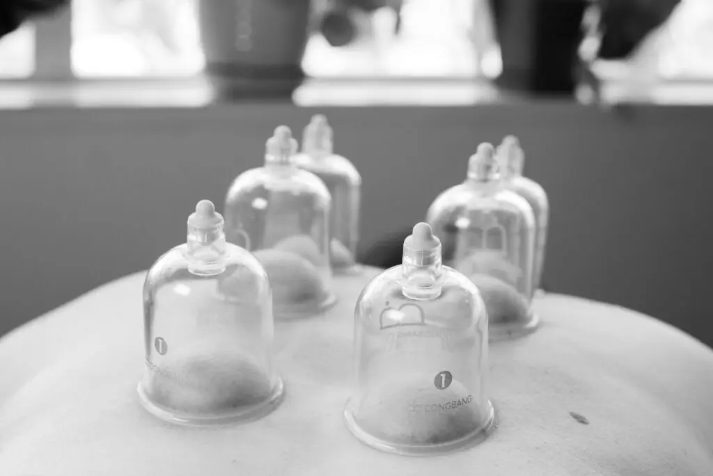 Hands-on acupuncture treatment